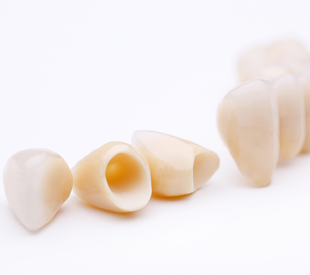 Cumming Dental Crowns and Dental Bridges