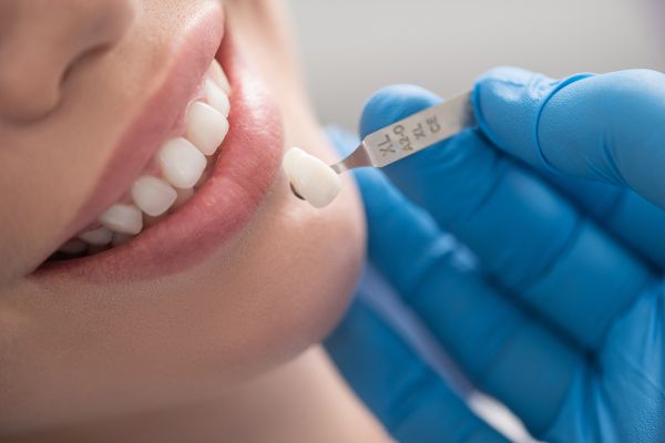 Learn How A Veneers Dentist In Cumming Can Transform Your Smile