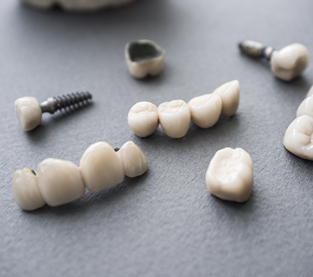 Cumming The Difference Between Dental Implants and Mini Dental Implants