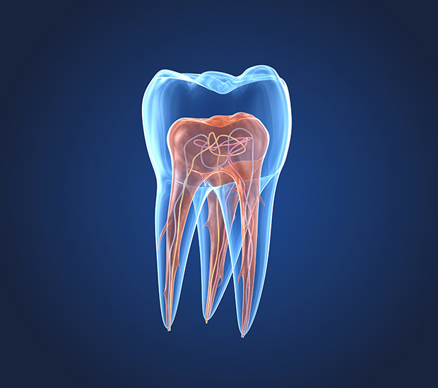 Cumming What is an Endodontist